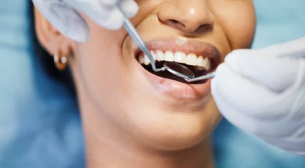 Best Emergency Tooth Extraction  in San Mateo, CA