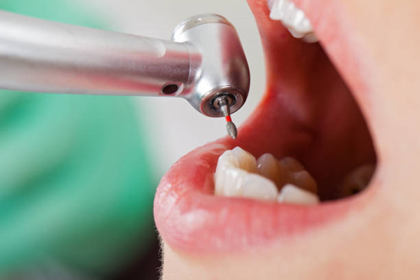 Best Tooth Pain Emergency Relief  in San Mateo, CA